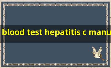 blood test hepatitis c manufacturer